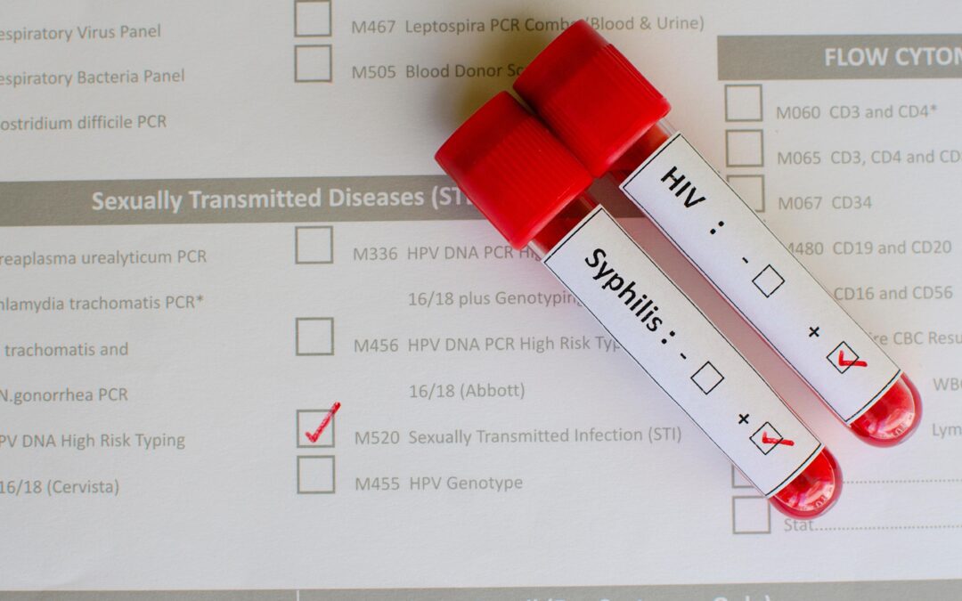 HIV virus, medical concept, Human Immunodeficiency Virus Positive test